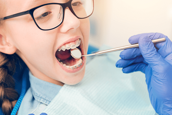 Orthodontic treatment 1 min